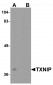 TXNIP Antibody