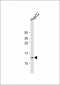 COX7A2L Antibody (Center)