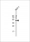 SUV39H1 Antibody (N-term)