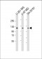 SH3PXD2B Antibody (C-Term)