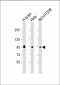GALC Antibody (N-Term)