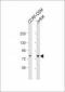 ND5 Antibody (C-term)