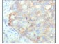 KARS Antibody