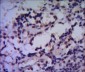 HSP70 Antibody