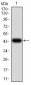 Tlr2 Antibody