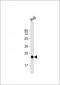 UQCRFS1 Antibody (C-term)