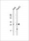 MRPL28 Antibody (N-term)