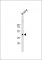 Mouse Plau Antibody (C-term)