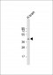 PKA C-beta (PRKACB) Antibody (N-term)