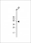 CSNK1G2 Antibody (C-term)