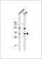 HSD17B3 Antibody (Center)