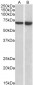 Goat Anti-LCP1 / plastin-2 Antibody (internal region)