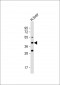 FADS6 Antibody (C-term)