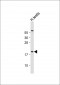 CT45A Antibody (Center)