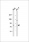 KCTD3 Antibody (C-term)