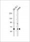 PPM1D Antibody (Center)