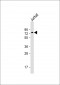 CPSF6 Antibody (N-term)