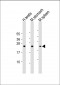 NAA40 Antibody (C-Term)