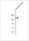 AGL Antibody (N-term)