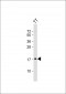 Kallikrein 7 Antibody (Center)