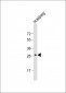 DIO1 Antibody (N-term)