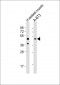 KIST (KIS) Antibody (C-term)