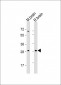 ARHE Antibody (Center)