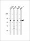 COL17A1 Antibody (Center)