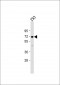 PLCZ1 Antibody (N-term)