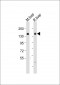 PLCB3 Antibody (N-Term)