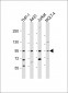 IL12_2 Antibody (C-term)