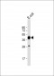 MBP tag Antibody