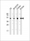 SLC2A3 Antibody (C-Term)