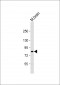 KIAA1524 Antibody (N-Term)