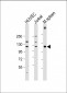 RIG-I Antibody (C-term)