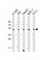 EEF1A1P5 Antibody (C-Term)