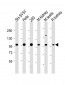 PGAP1 Antibody (N-Term)