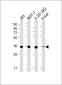 PDXK Antibody (N-term)