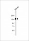 SASH1 Antibody (Center)