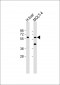 GLT8D4 Antibody(C-term)