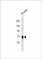 ST7 Antibody (Center)