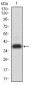 Mouse Monoclonal Antibody to ADAMTS1