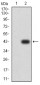 Mouse Monoclonal Antibody to ADAMTS1