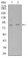 Mouse Monoclonal Antibody to ADAMTS1