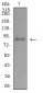 Mouse Monoclonal Antibody to ADAMTS1