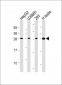 CLEC1B Antibody (N-Term)
