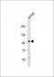 KIAA1524 Antibody (Center)