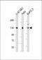 MGEA5 Antibody (N-Term)