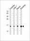 ATP6V1G3 Antibody (N-Term)