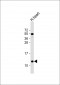 NDUFA2 Antibody (C-Term)